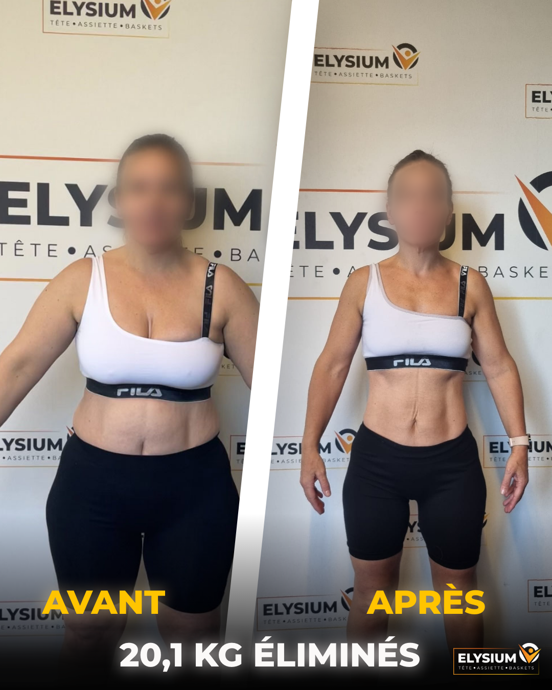 Transformation avant après d'Aline de face avec 20,1 kg éliminés