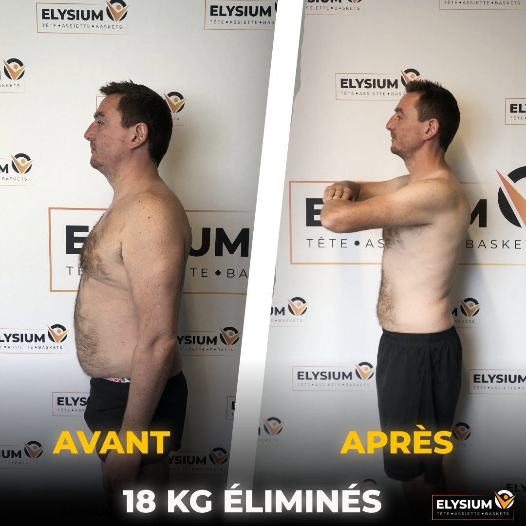 Transformation avant après d'Aymeric de profil avec 18 kg éliminés