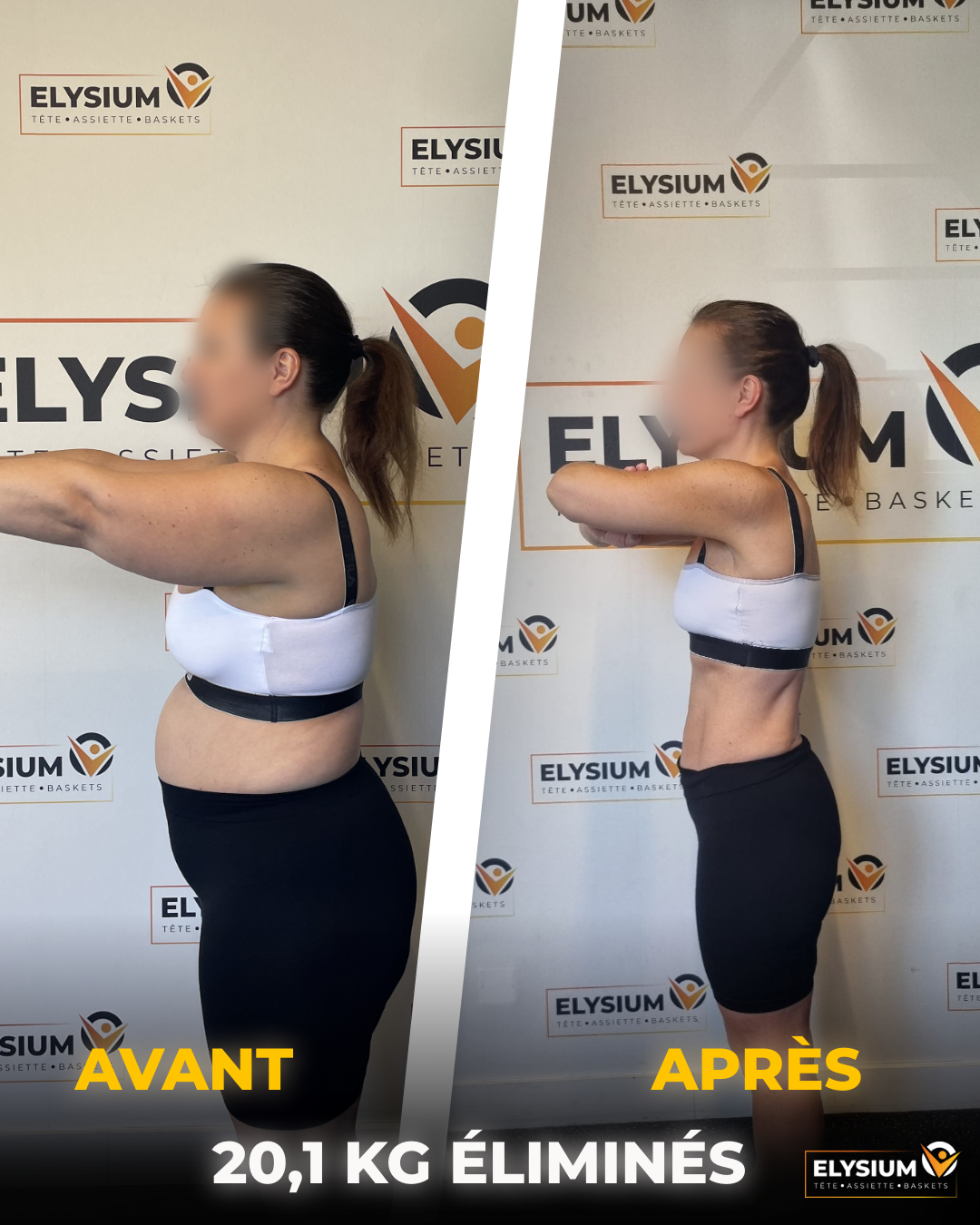 Transformation avant après d'Aline de profil avec 20,1 kg éliminés